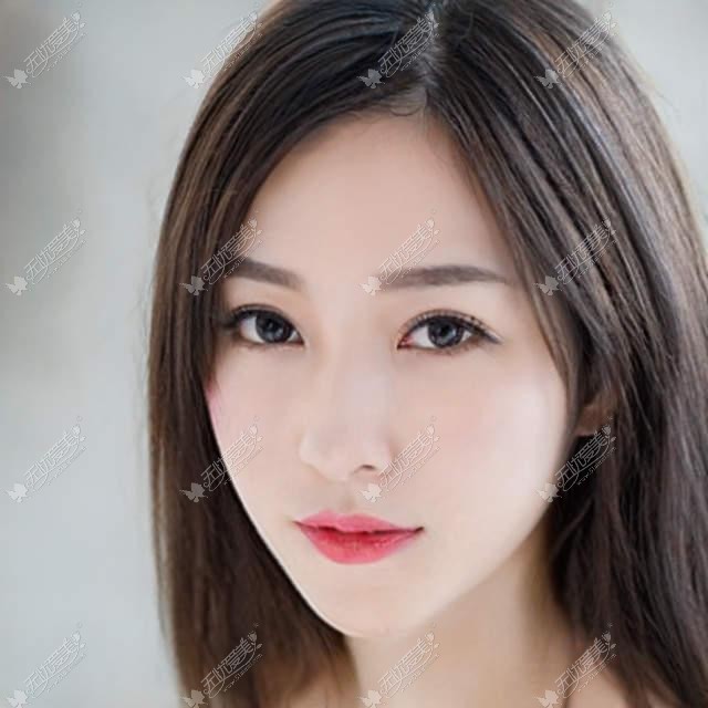 常州施尔美注射丰下巴需要多少钱