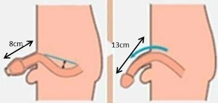 其他医院假体三件套价格对比