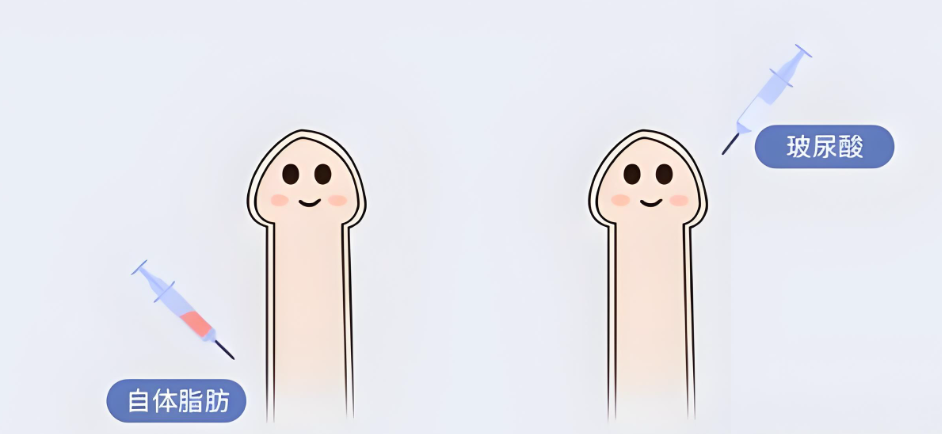 王文卫增粗手术价格常见疑问