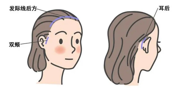 北京加减美医院做面部提升价格www.51aimei.com