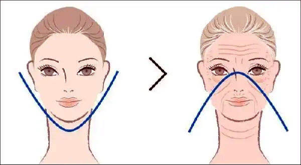 北京加减美V3手术