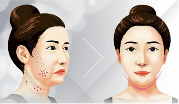 北京加减美拉皮