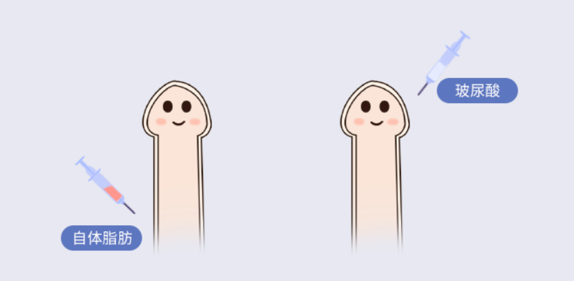 3种常见技术的价格差竟达1倍