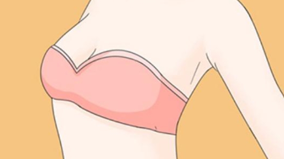 广州美莱医疗美容丰胸价格表：乳房下垂矫正2万多，傲诺拉闪耀假体丰胸4万元起