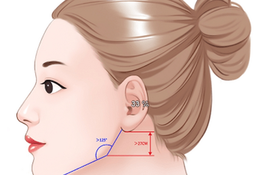 八大处做下颌角好的医生有谁www.51aimei.com