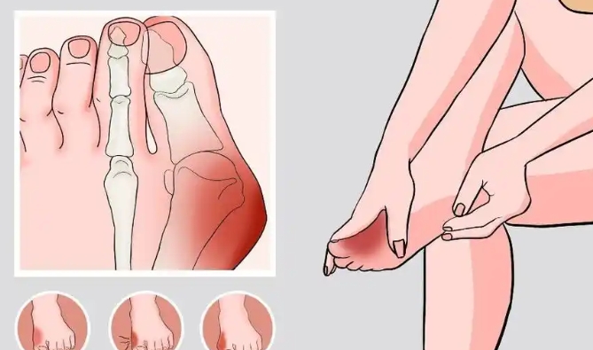 温建民治疗拇外翻在北京什么地方？3家医院地址、地铁口全标清！