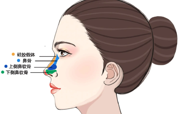 李保锴鼻子野生案例数据多，20年鼻修复医生做耳软骨隆鼻6万起，满意度高达98%