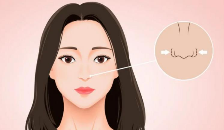 李保锴做鼻子到底怎么样？李保锴做肋软骨隆鼻和鼻修复经验多