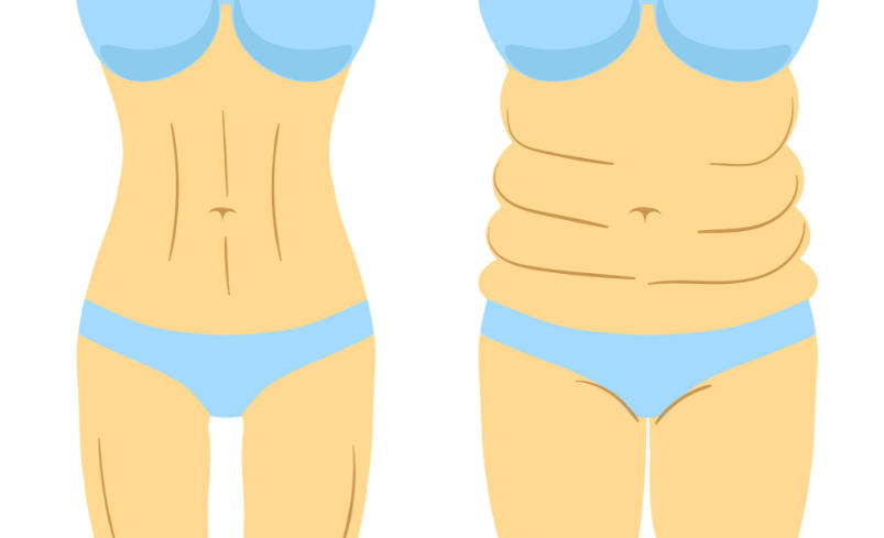 冯牧夷吸脂多少钱？重庆三家医院单部位4000起、全身5万起参考价