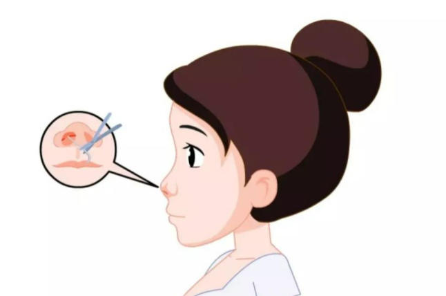 深圳隆鼻医生排行榜出炉！王天国凭桃花鼻技术稳居前三，速看排名