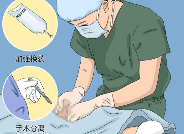 李世荣延长手术具体价格表(2025年重庆星荣医院)