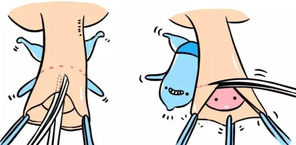 李世荣延长手术疗效及患者反馈参考