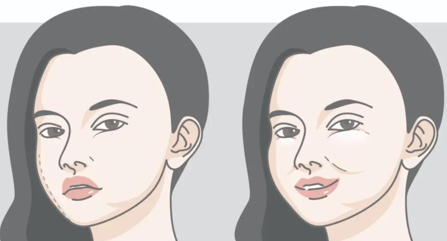 张立彬馒化修复贵吗？额头修复3万起-下巴修复1.5万元起