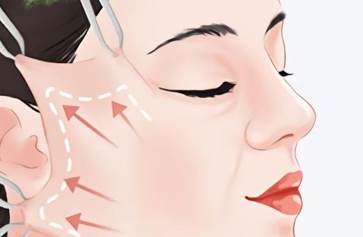 郑州的魏广运医生怎么样？魏广运做拉皮技术可靠-切口在发际线里