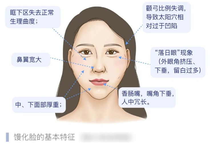 杭州幼态脸打造哪家好？这3家医美机构技术稳+价格透明（附医生+地址）