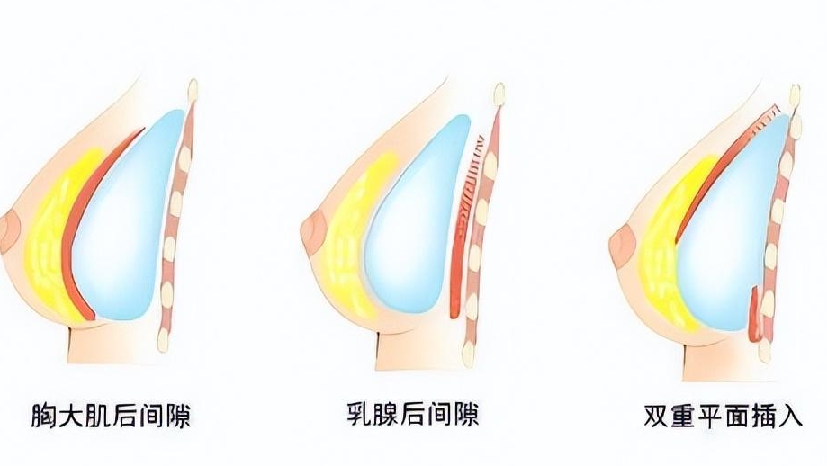 傲诺拉星熠毛面怎么样