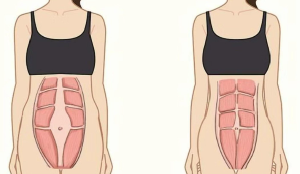 三维筋膜复位术