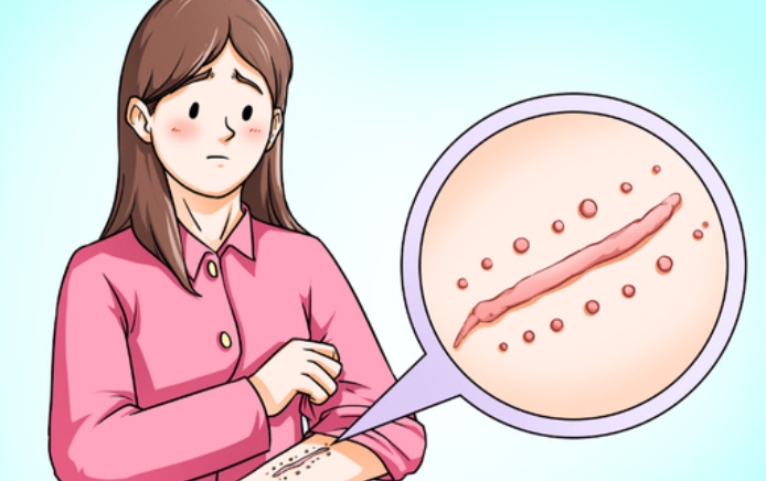 广州曙光医院疤痕