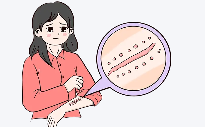 广州曙光医院疤痕修复价格差异原因