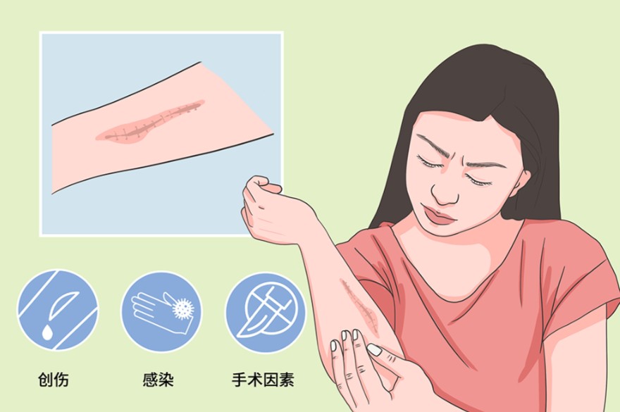 李玉坤疤痕修复
