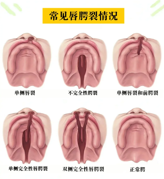李昌斌美学修复口碑