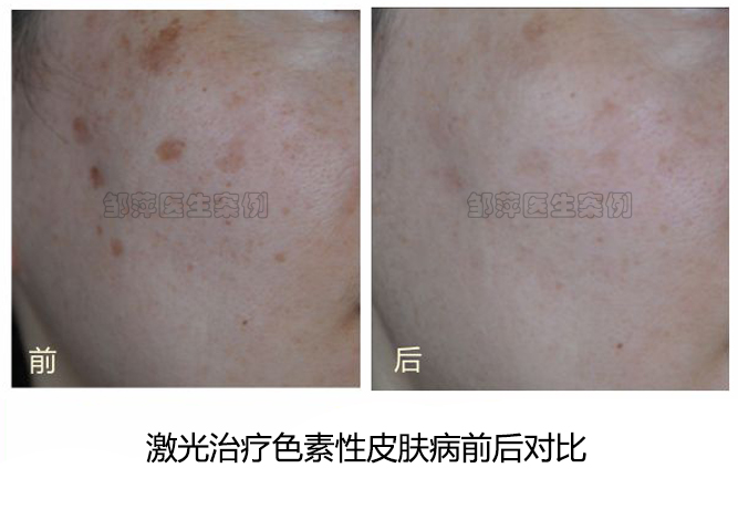 二、济南华夏医院特色项目价格www.51aimei.com