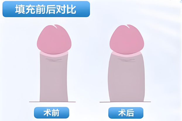 南京金陵男科医院徐承良医生