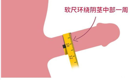 一、咸阳阴茎增粗手术医院推荐www.51aimei.com