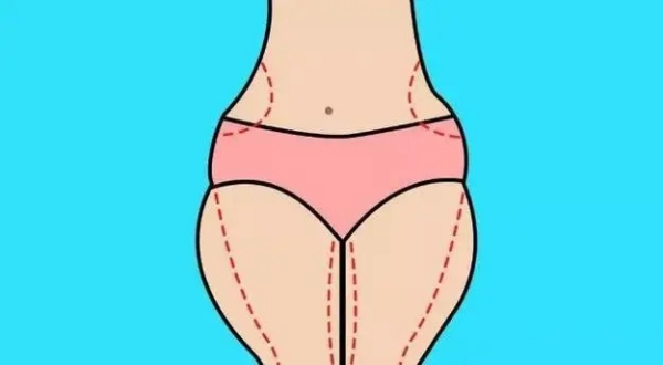 腰腹环吸术后真实感受