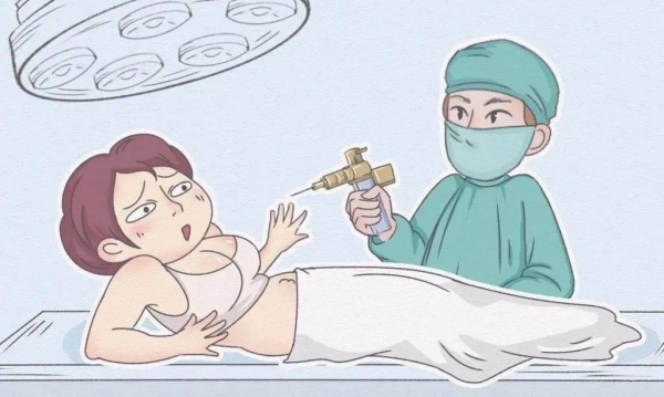 腰腹环吸塑形