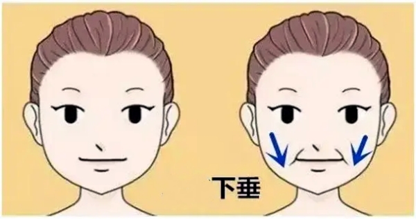 谁让穆宝安做过面部提升