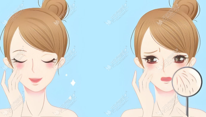 南京美贝尔光子嫩肤 南京美贝尔光子嫩肤