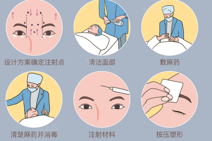 额头填充：要平整，不要寿星公