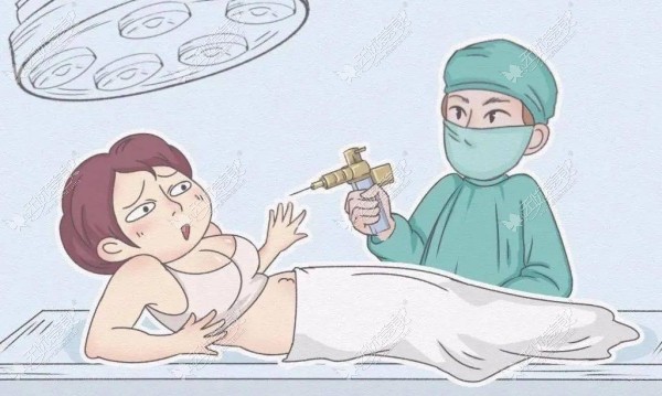 吸脂.jpg