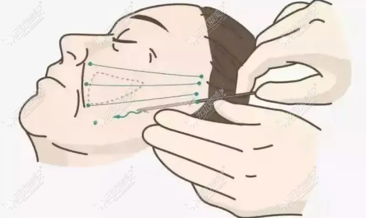 20260421163160838.png image.png