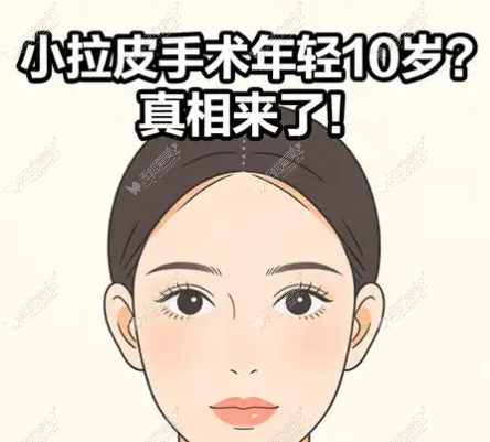 20260421164419953.png image.png