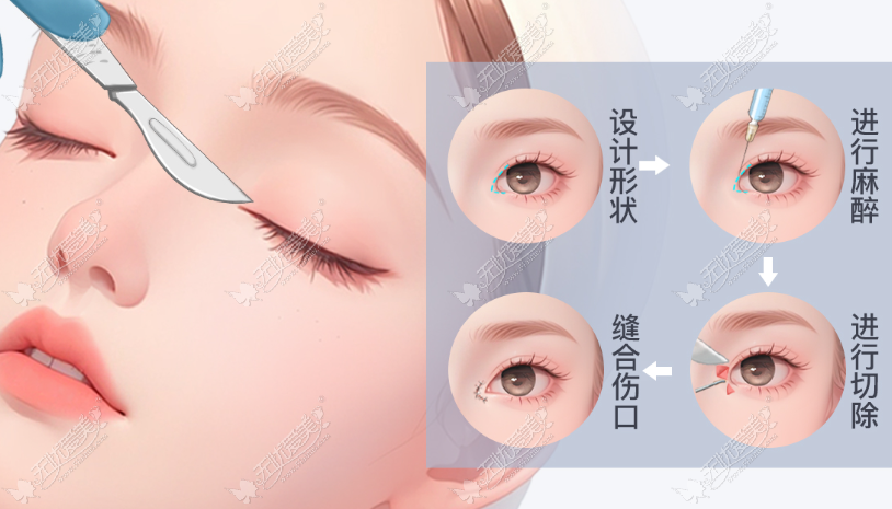 20260422091712504.png image.png