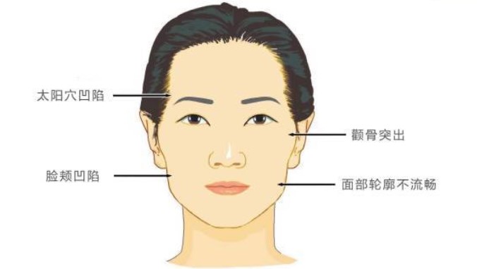 三、杭州米兰柏羽彭涛不同部位吸脂的价格区间与方案选择www.51aimei.com