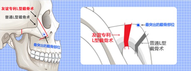四、真实反馈:那些毕业学姐是怎么评价黄大勇医生的?