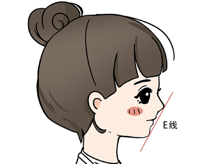 上海卢建peek下巴价格构成与费用明细