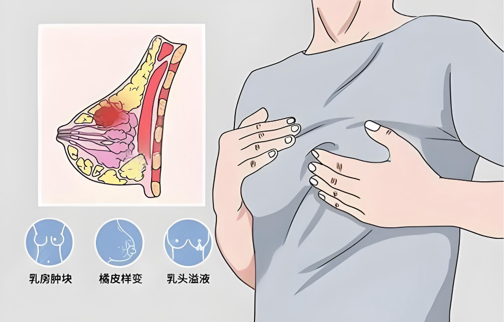 杨庆华胸部奥美定取出价格差异原因深度剖析