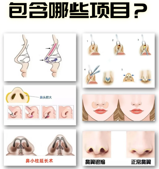 长沙do鼻医生推荐排名榜她策了蛮久才敢发出来,妹坨们一看就晓得是真做了功课的