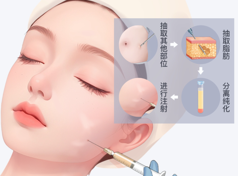 缺点：