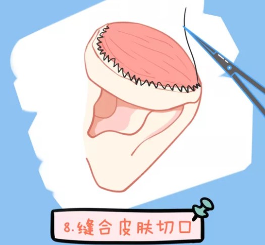 三、实操干货:手把手教你如何有效预约到安波院长