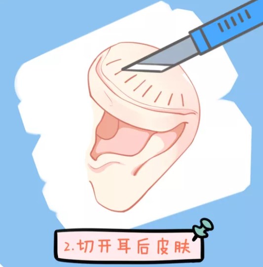 四、细节感拉满:去见安波院长前必须准备好的三件事