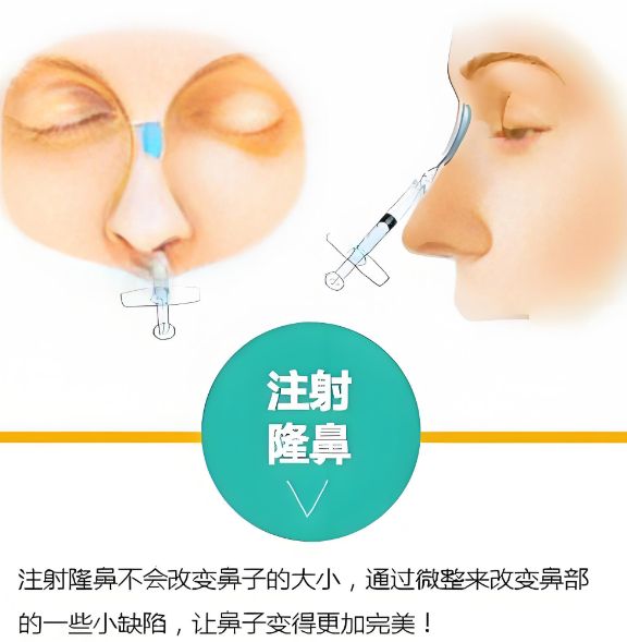 三、 北京漾格李在郁在美卫士方案：让每一分钱都花在刀刃上