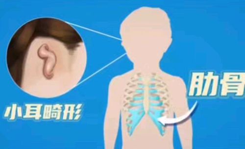4. “术后孩子多久能出院?多久能正常上学?”