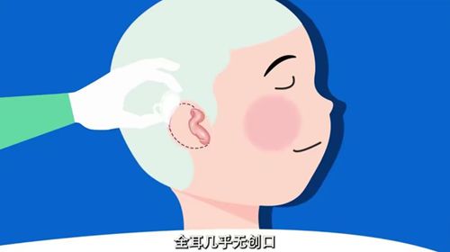 3. “总费用是多少?医保能报多少?”