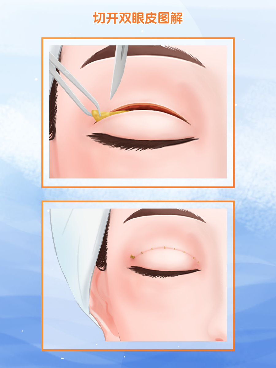 四、武汉协丽卓美整形大家较关心的五个实际问题www.51aimei.com