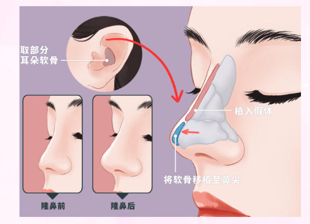 二、“非初鼻”面诊必备:如何准备既往手术资料